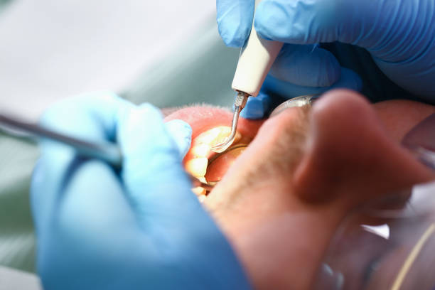 Best Emergency Cosmetic Dentistry (e.g., broken veneers) in Troutman, NC